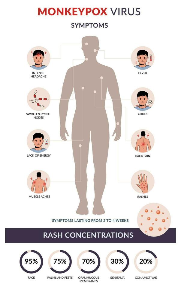 viruela del simio virus síntomas plano vector infografía. erupción concentración. brote infecciones