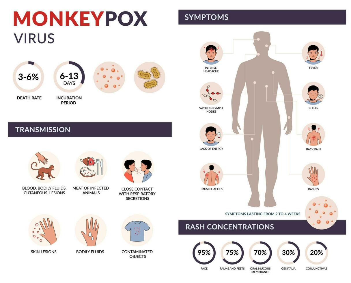 viruela del simio virus transmisión, síntomas, erupción concentración vector infografía con iconos infección extensión desde mono. plano diseño