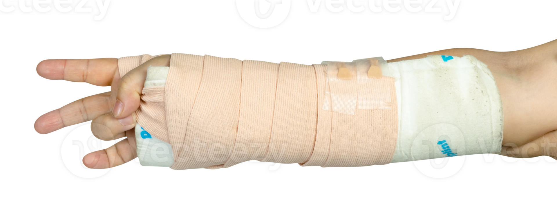 Hand making physical therapy to broken wrist from accident isolated png