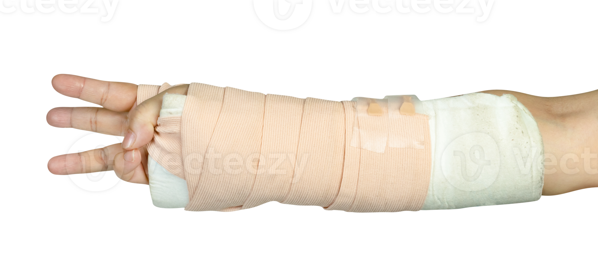 Hand making physical therapy to broken wrist from accident isolated png
