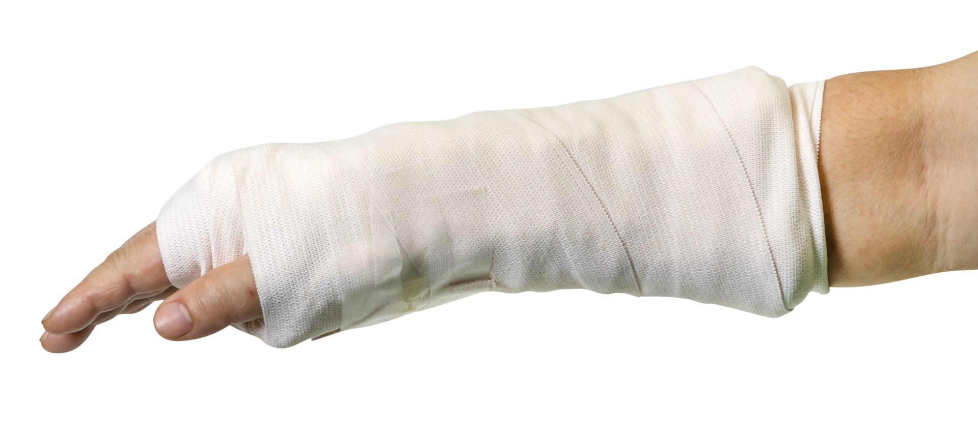 broken arm splinting from accident isolated 23257868 PNG