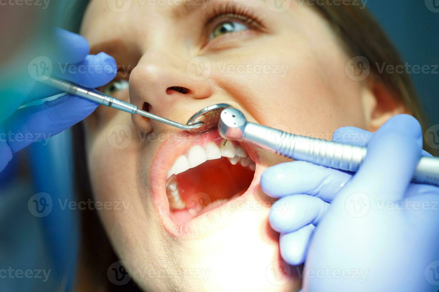 Woman getting a dental treatment photo
