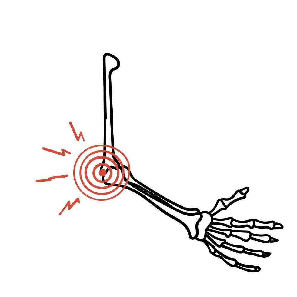 mano dibujado garabatear hueso articulación dolor ilustración vector