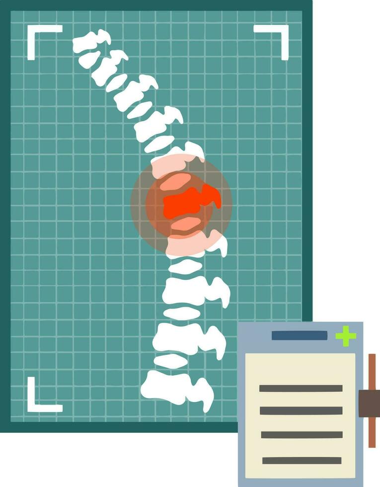 Problems with spine. Posture issues. Sick red place. Crack in White bone. Magnifying glass. Logo in circle. Vertebral column. X-ray of internal organs. Medical care. Fracture of intervertebral discs vector