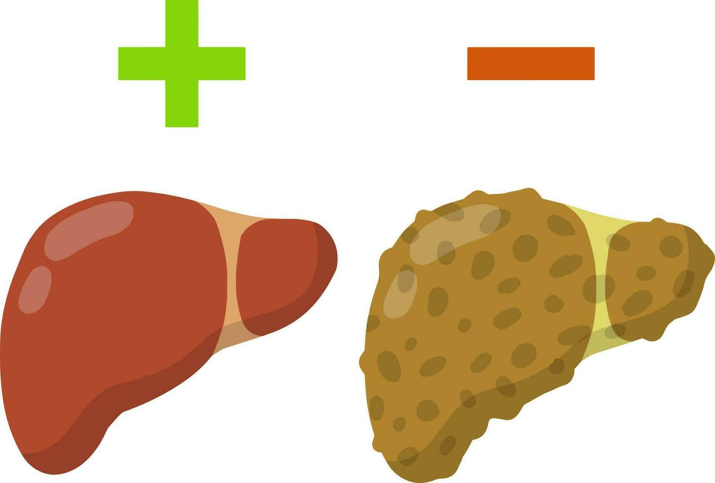 Healthy and diseased liver. Healthy and unhealthy diet. Plus and minus. Cartoon flat illustration vector
