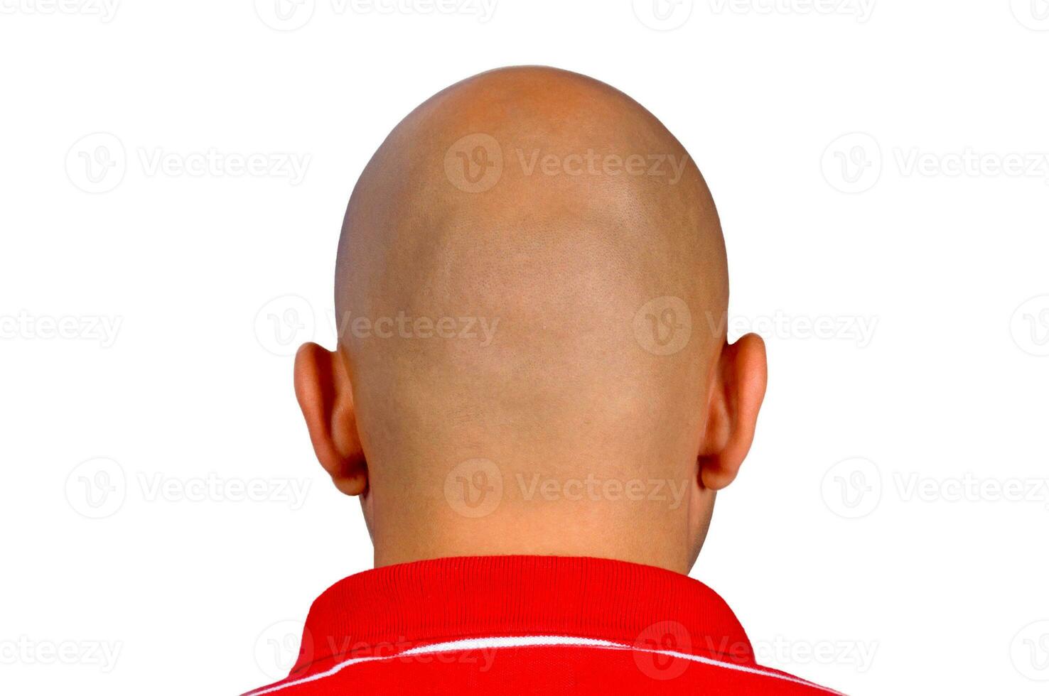 Bald head concept photo