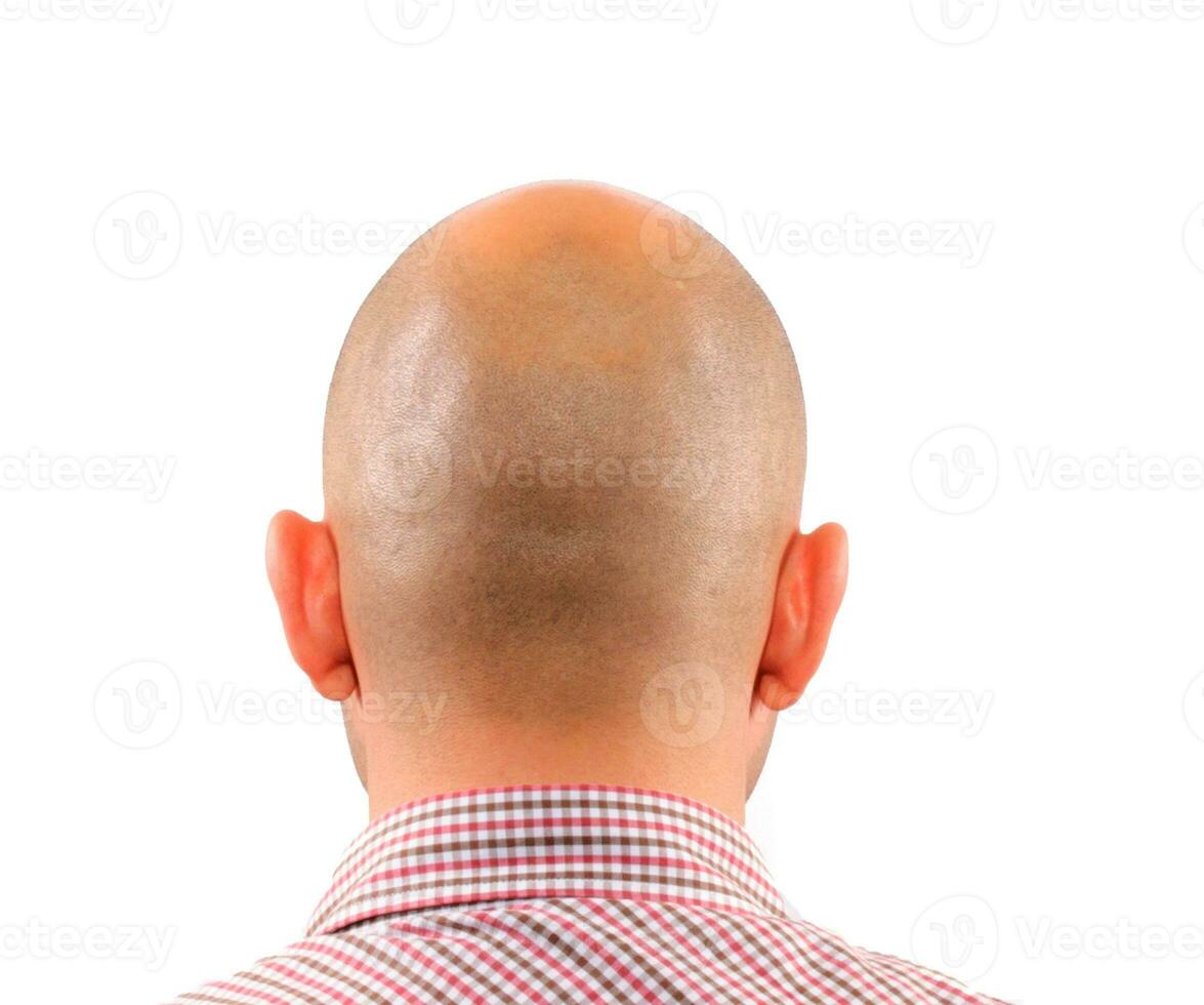 calvicie aislado en blanco foto