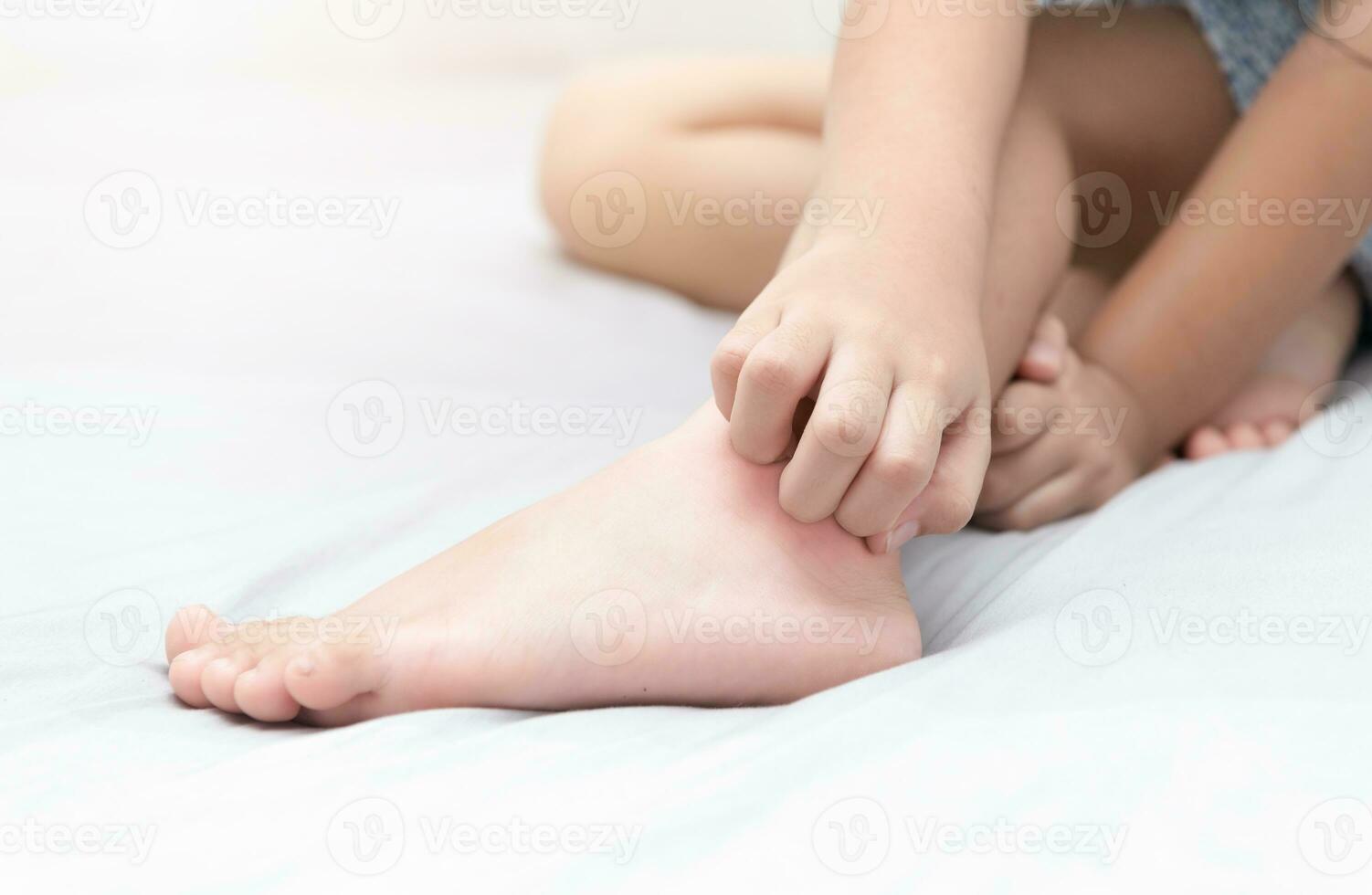 girl scratch the itch with hand on bed photo