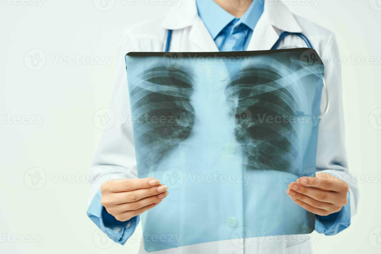 female doctor hospital examination xray health 23382024 Stock Photo at