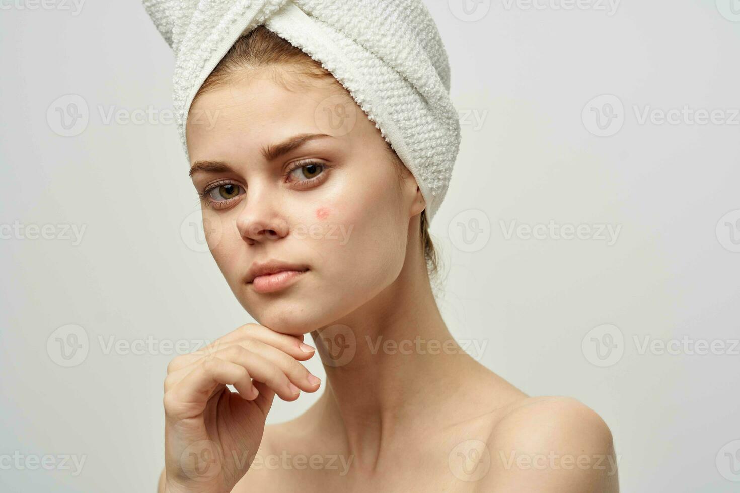 pretty woman with a pimple on the face skin problems close-up photo