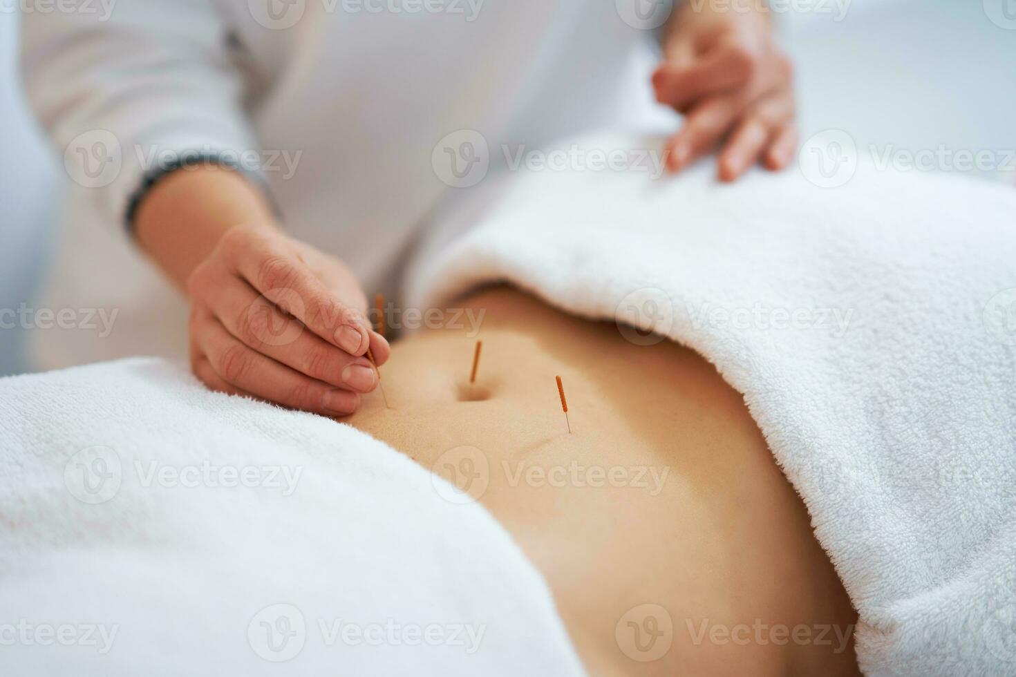 A acupuncture needle therapy in the studio photo