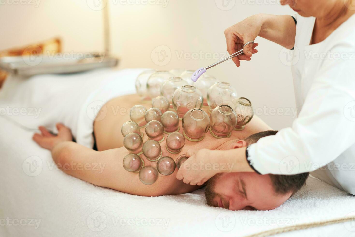 A picture of a man having cupping therapy photo