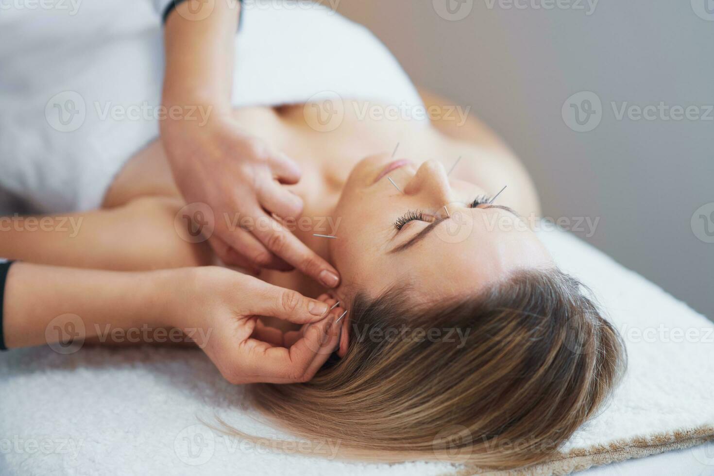 A acupuncture needle therapy in the studio photo