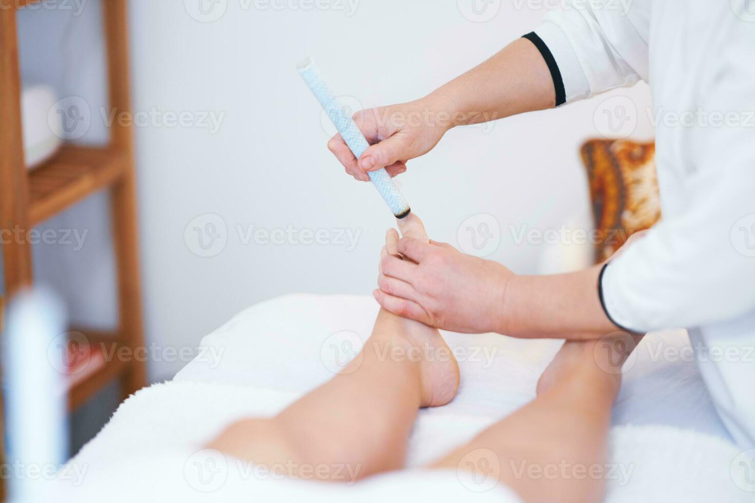 Picture of moxibustion therapy on woman body photo