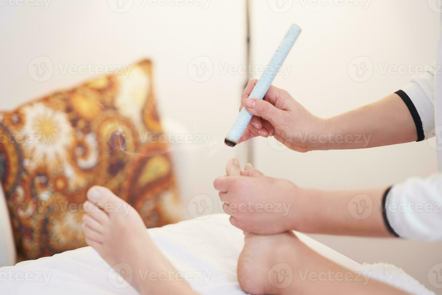 Picture of moxibustion therapy on woman body photo