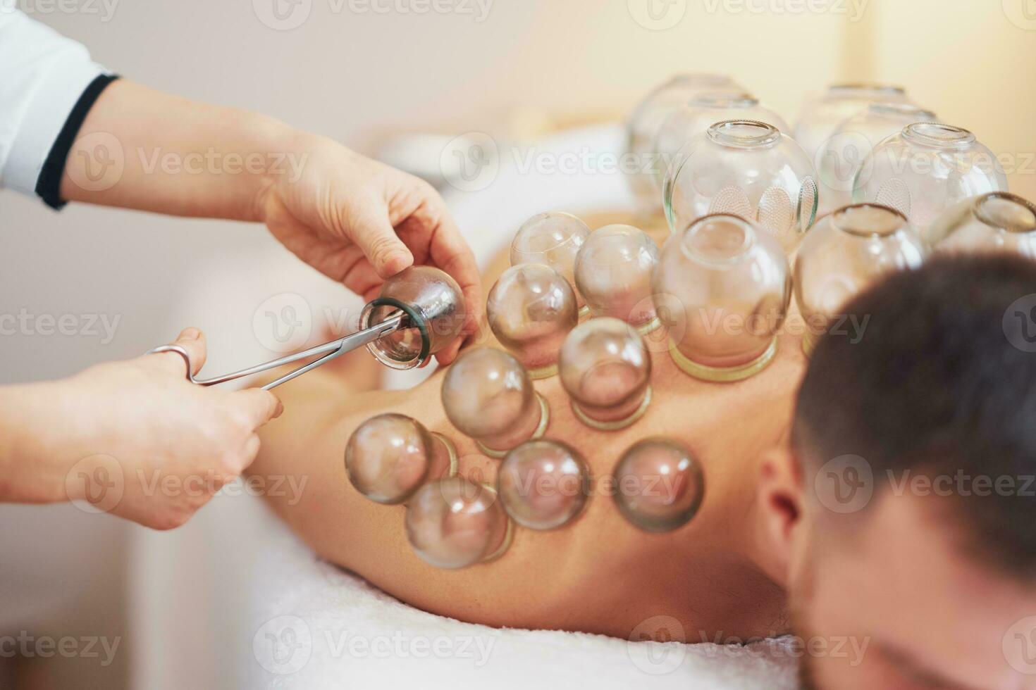 A picture of a man having cupping therapy photo