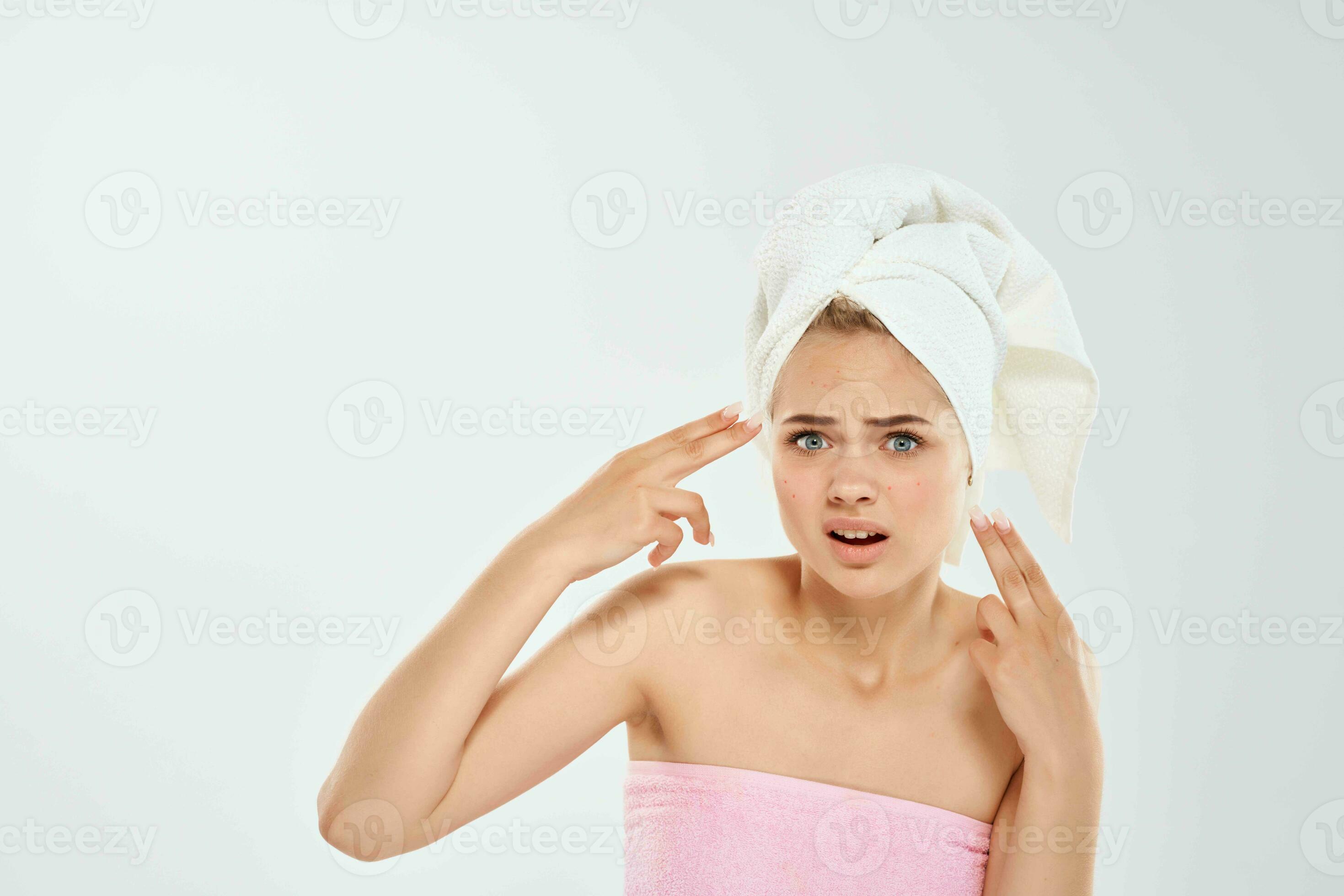 woman with bare shoulders pimples on face dermatology dissatisfaction