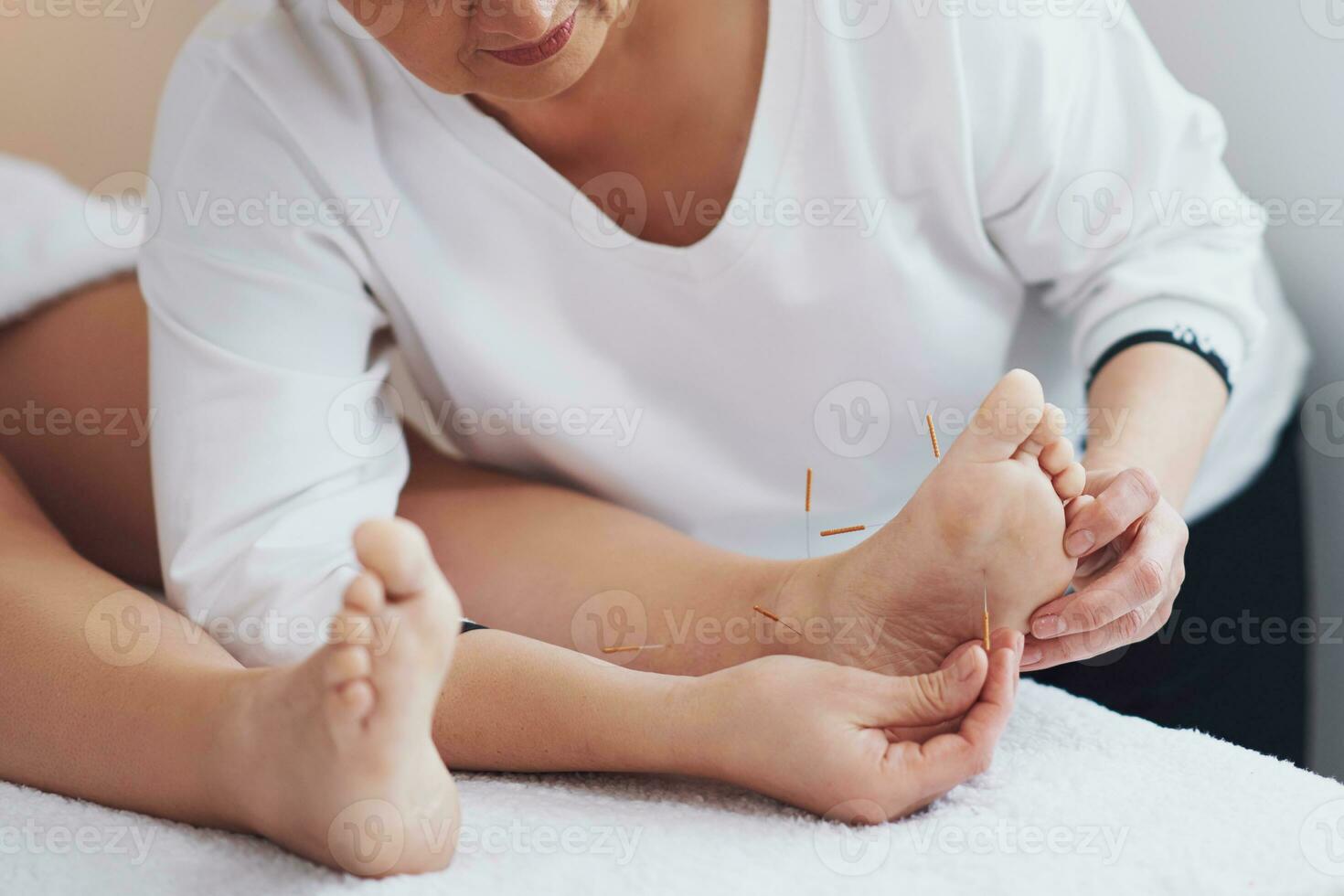 un acupuntura aguja terapia en el estudio foto