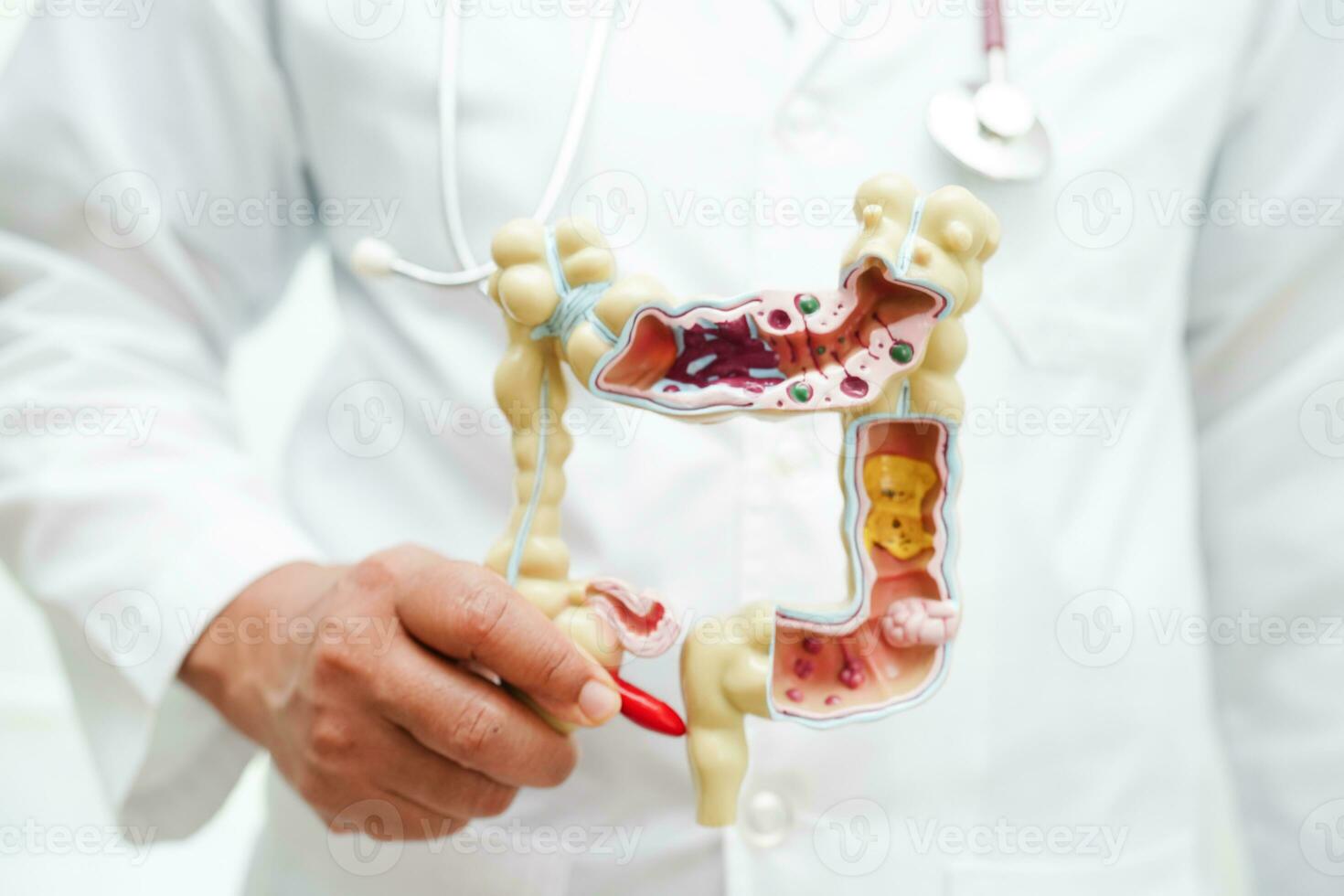 Intestine, doctor holding anatomy model for study diagnosis and treatment in hospital. photo