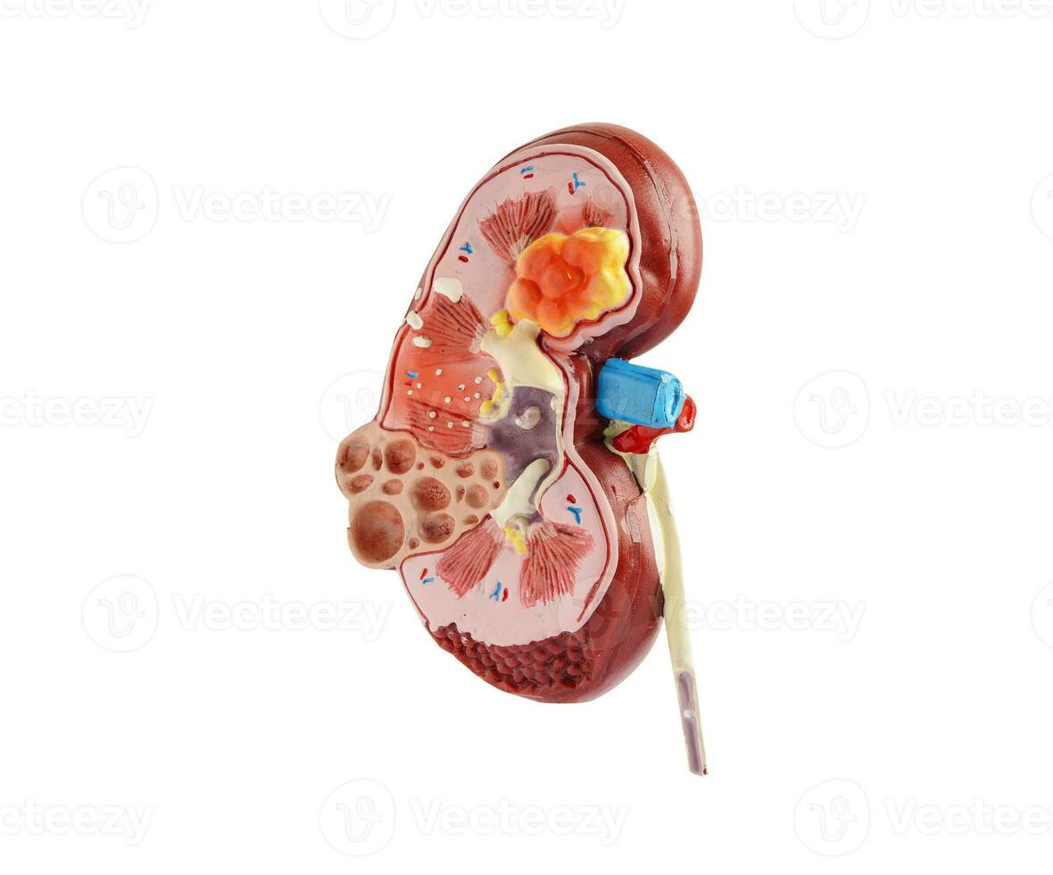 riñón modelo aislado en blanco antecedentes con recorte camino. crónico riñón enfermedad, tratamiento urinario sistema, urología, estimado glomerular filtración Velocidad egfr. foto