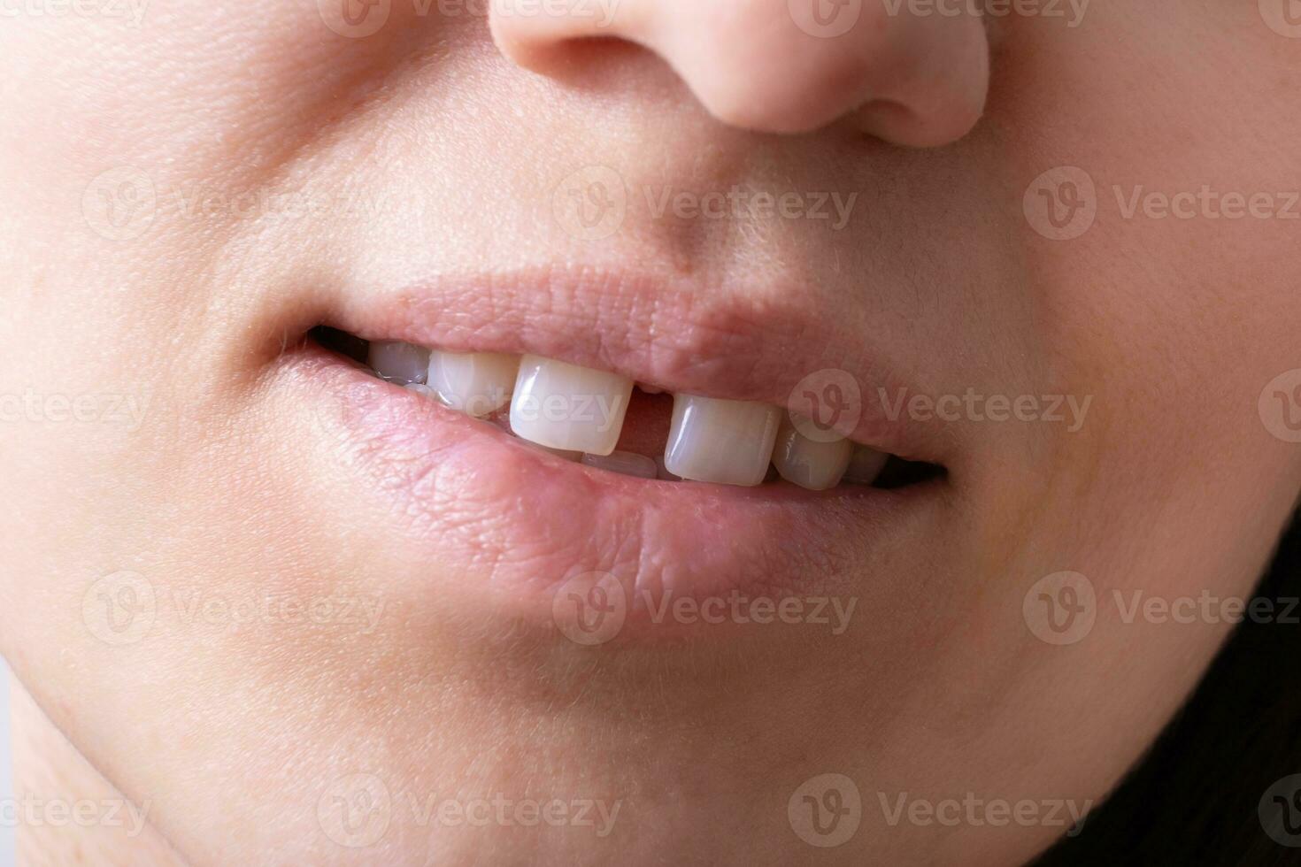 cerca arriba de mujer abierto sonriente boca con brecha dientes labios y raro dientes foto