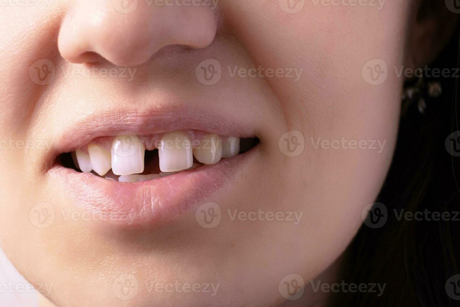 cerca arriba de mujer abierto sonriente boca con brecha dientes labios y raro dientes foto