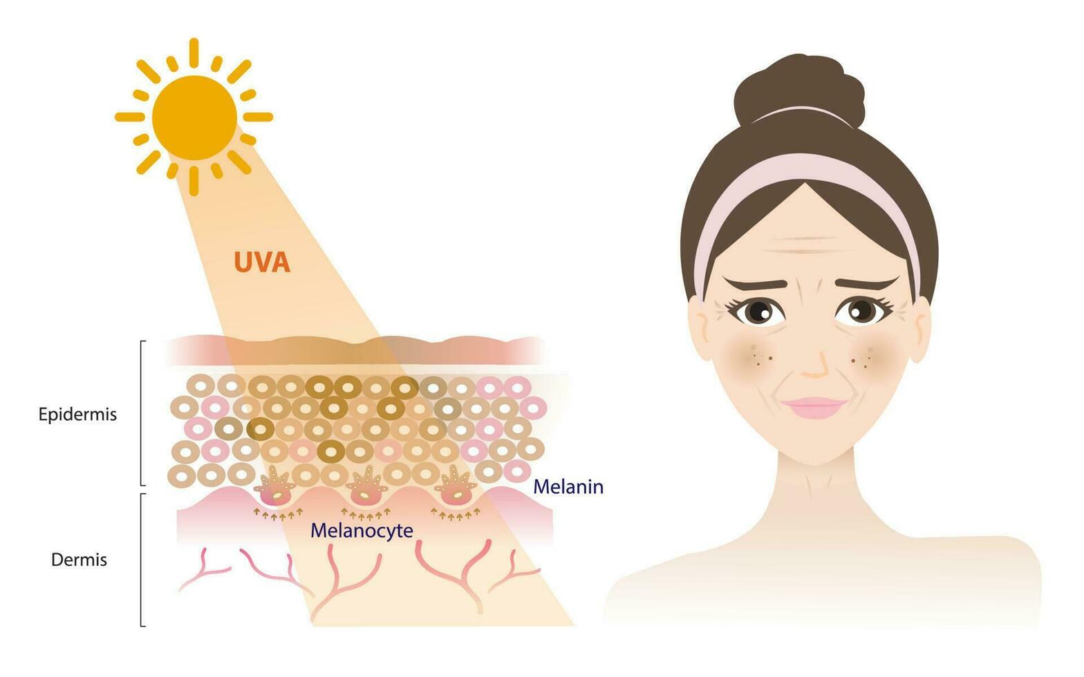 uva rayos penetrar dentro el dermis piel capa, dañar mujer rostro, resultante en un broncearse, melasmas, envejecimiento, arruga, oscuro lugares vector aislado en blanco antecedentes. piel cuidado concepto ilustración.