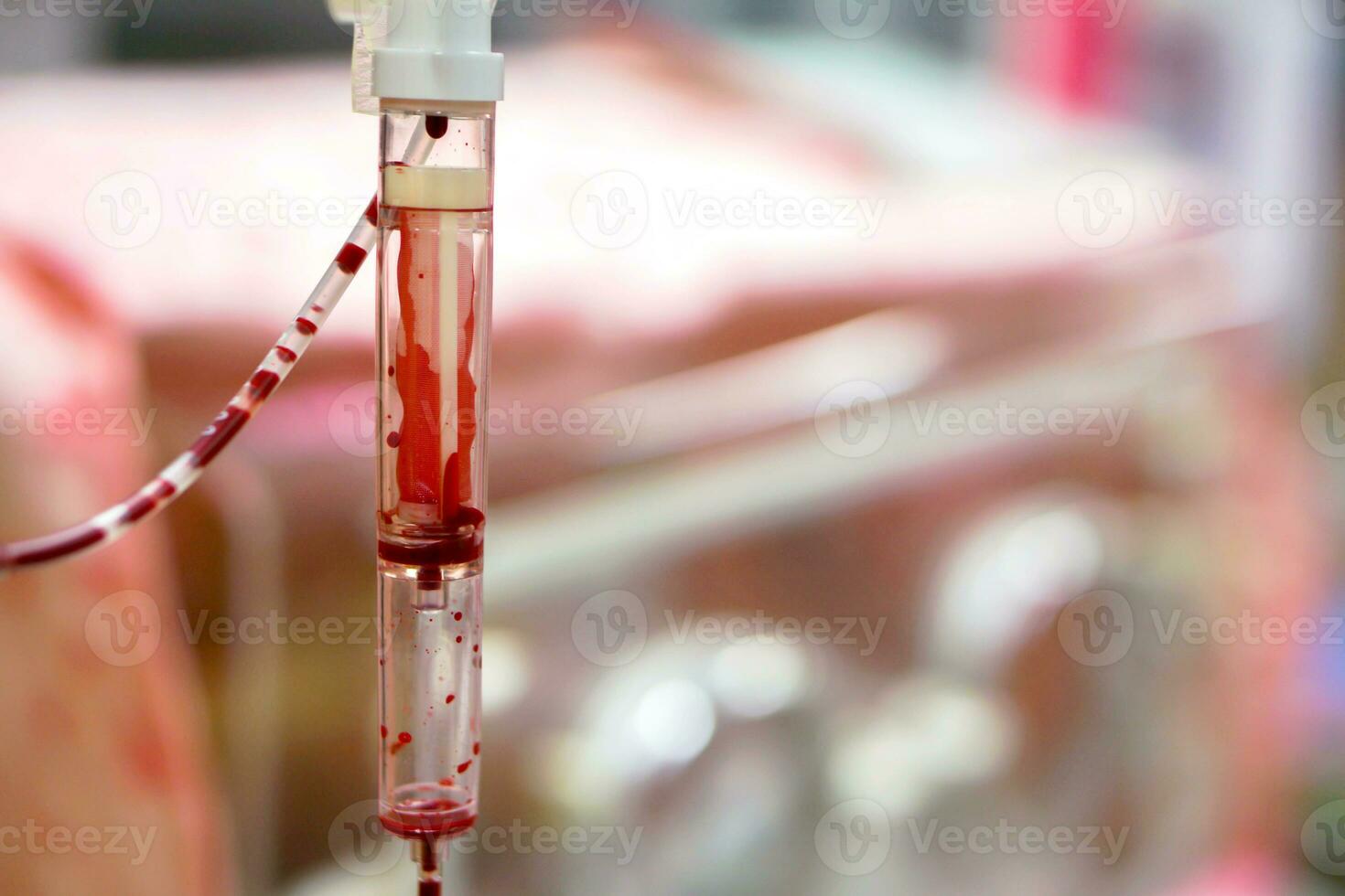 Closeup blood in tube transferring to a sick newborn baby on blurry baby incubator background. photo