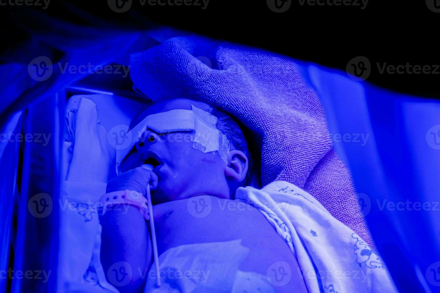 Closeup sick newborn baby sleeping on baby bed with ultraviolet lights