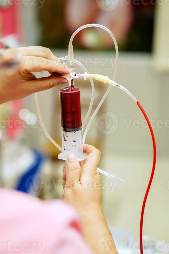 enfermero manos es ajustando el jeringuilla a dibujar sangre desde el sangre bolso para sangre transfusión a enfermo recién nacido bebé en un hospital. foto