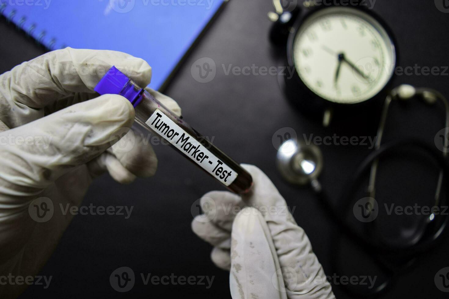 Tumor Marker - Test with blood sample. Top view isolated on black background. Healthcare Medical concept photo