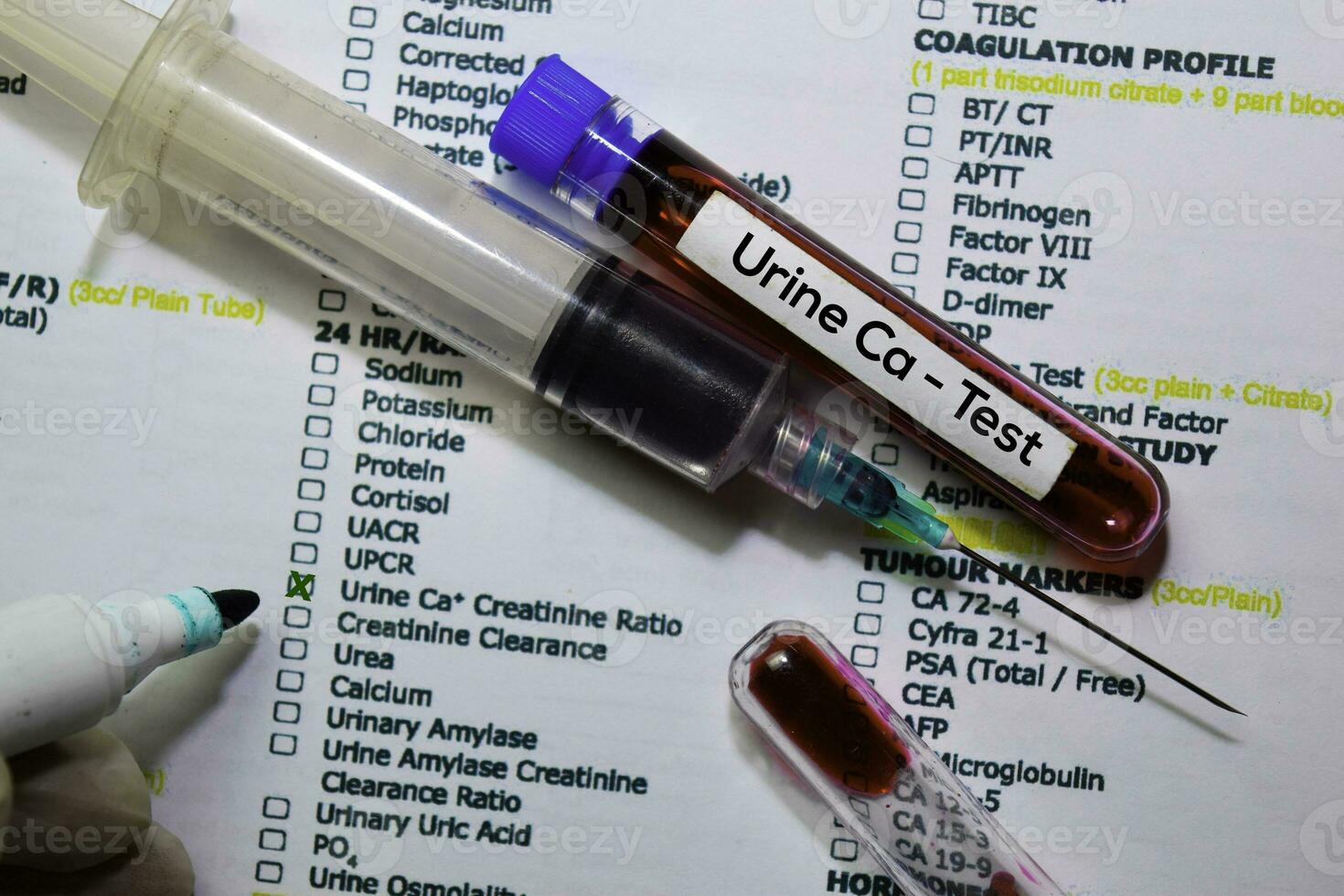Urine Ca - Test with blood sample. Top view isolated on office desk. Healthcare Medical concept photo