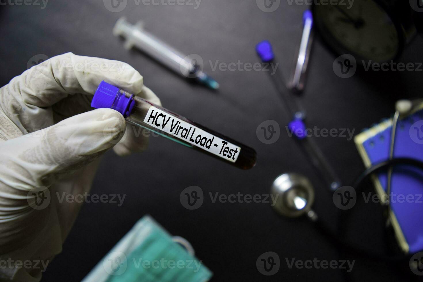 HCV Viral Load - Test with blood sample. Top view isolated on black background. Healthcare Medical concept photo