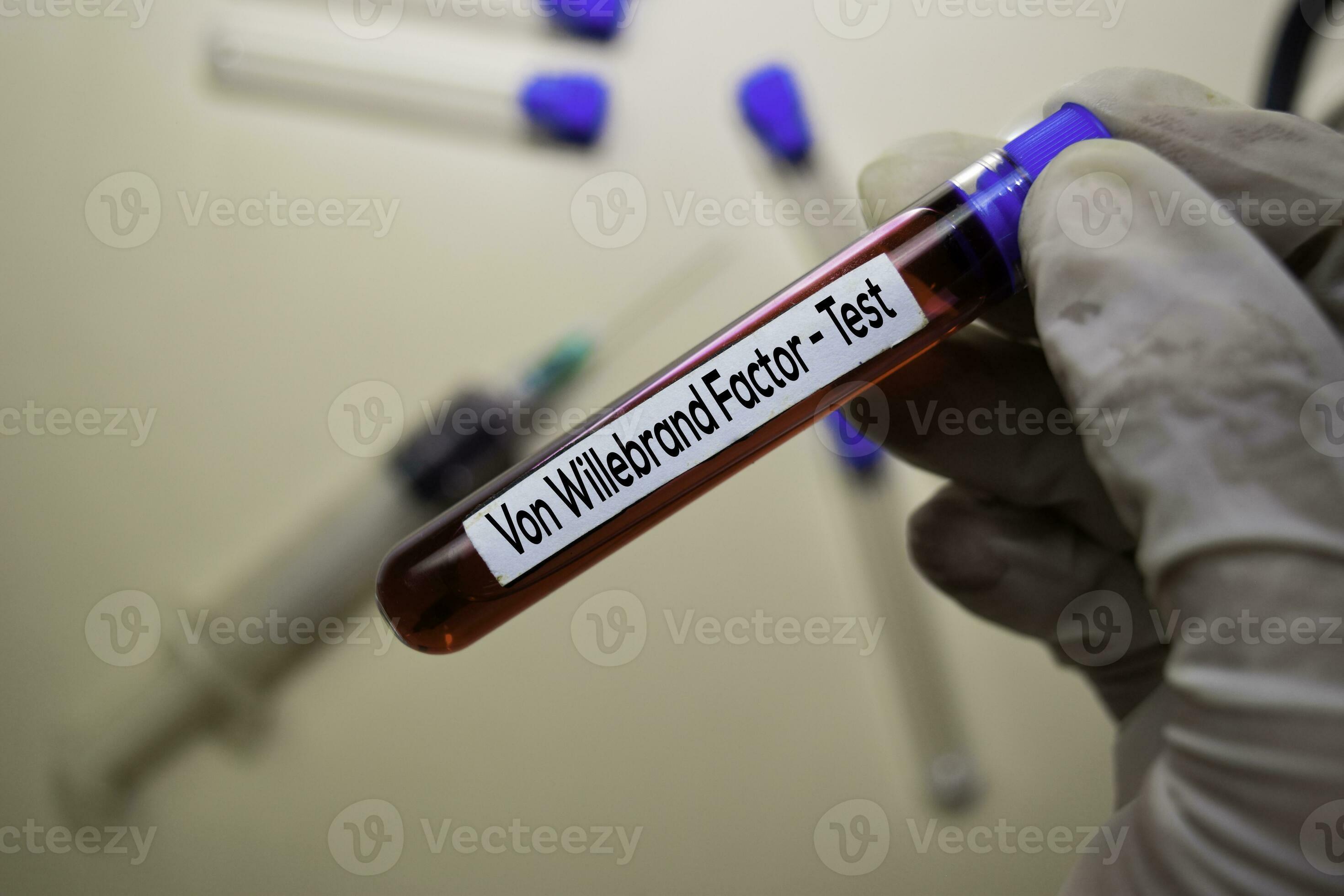 Von Willebrand Factor Test with blood sample. Top view isolated on Von Willebrand Factor Test with blood sample. Top view isolated on