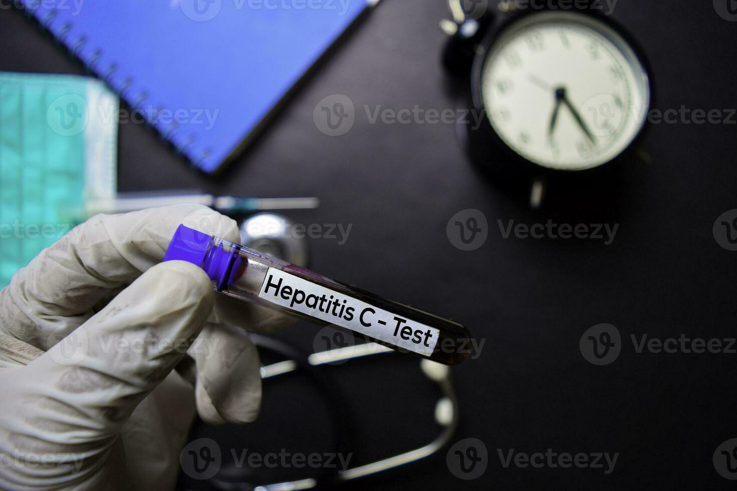 Hepatitis C - Test with blood sample. Top view isolated on black background. Healthcare Medical concept photo