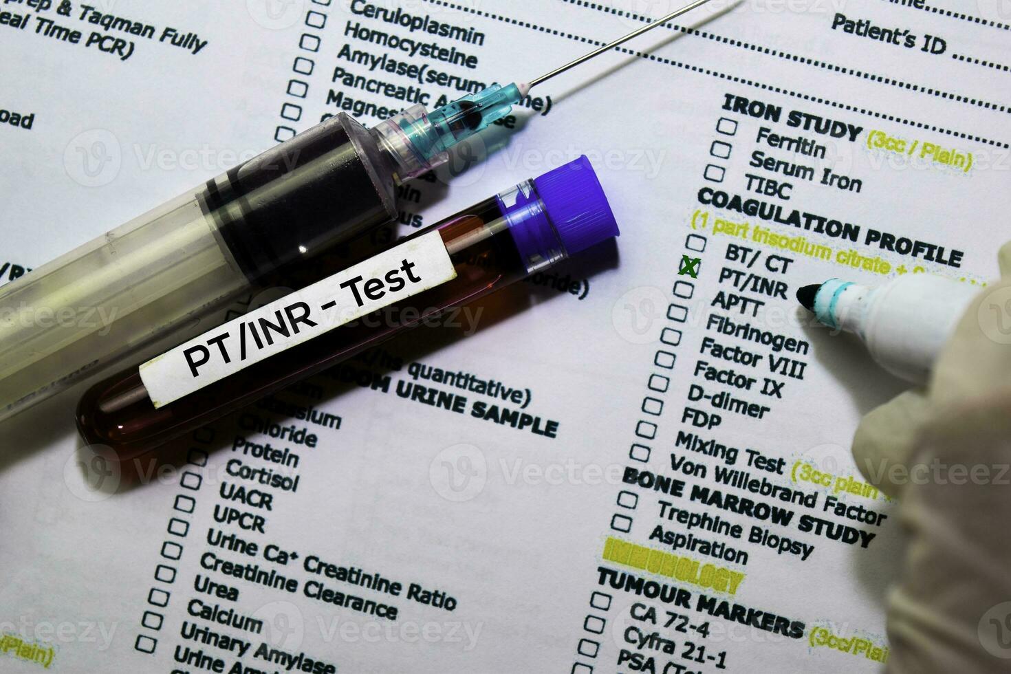 PT NR - Test with blood sample. Top view isolated on office desk. Healthcare Medical concept photo