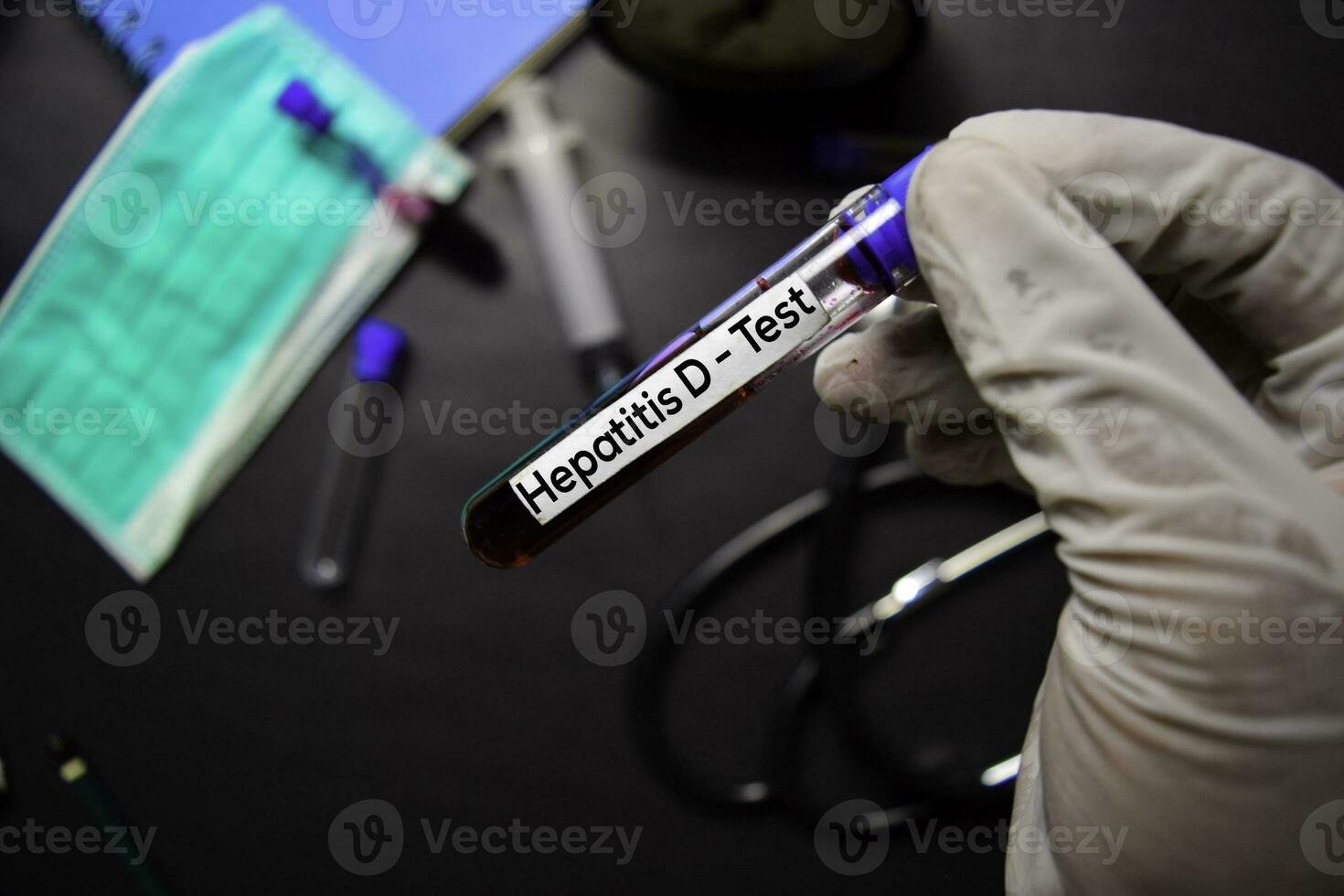 Hepatitis D - Test with blood sample. Top view isolated on black background. Healthcare Medical concept photo