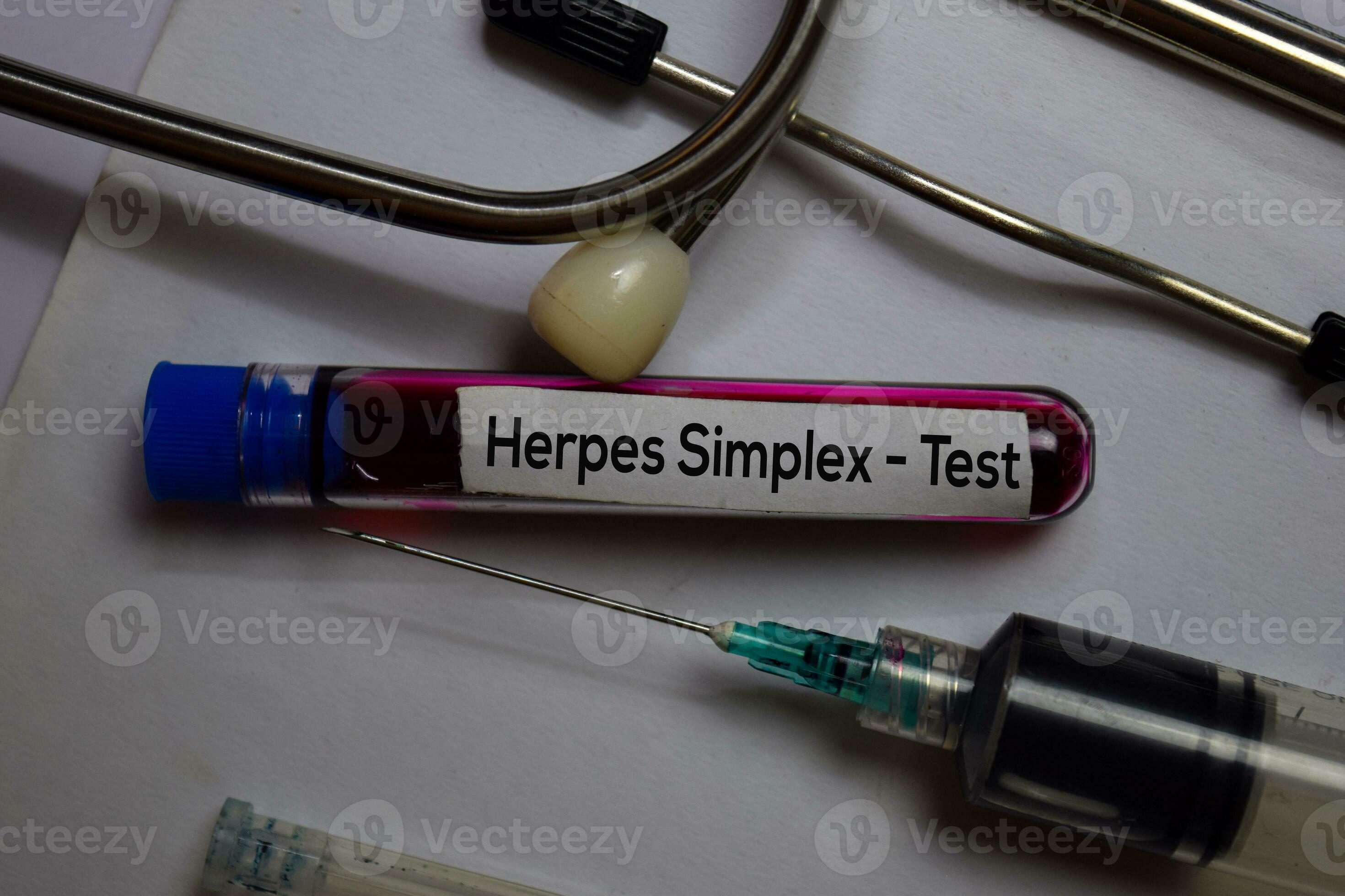 Herpes Simplex Test with blood sample. Top view isolated on office