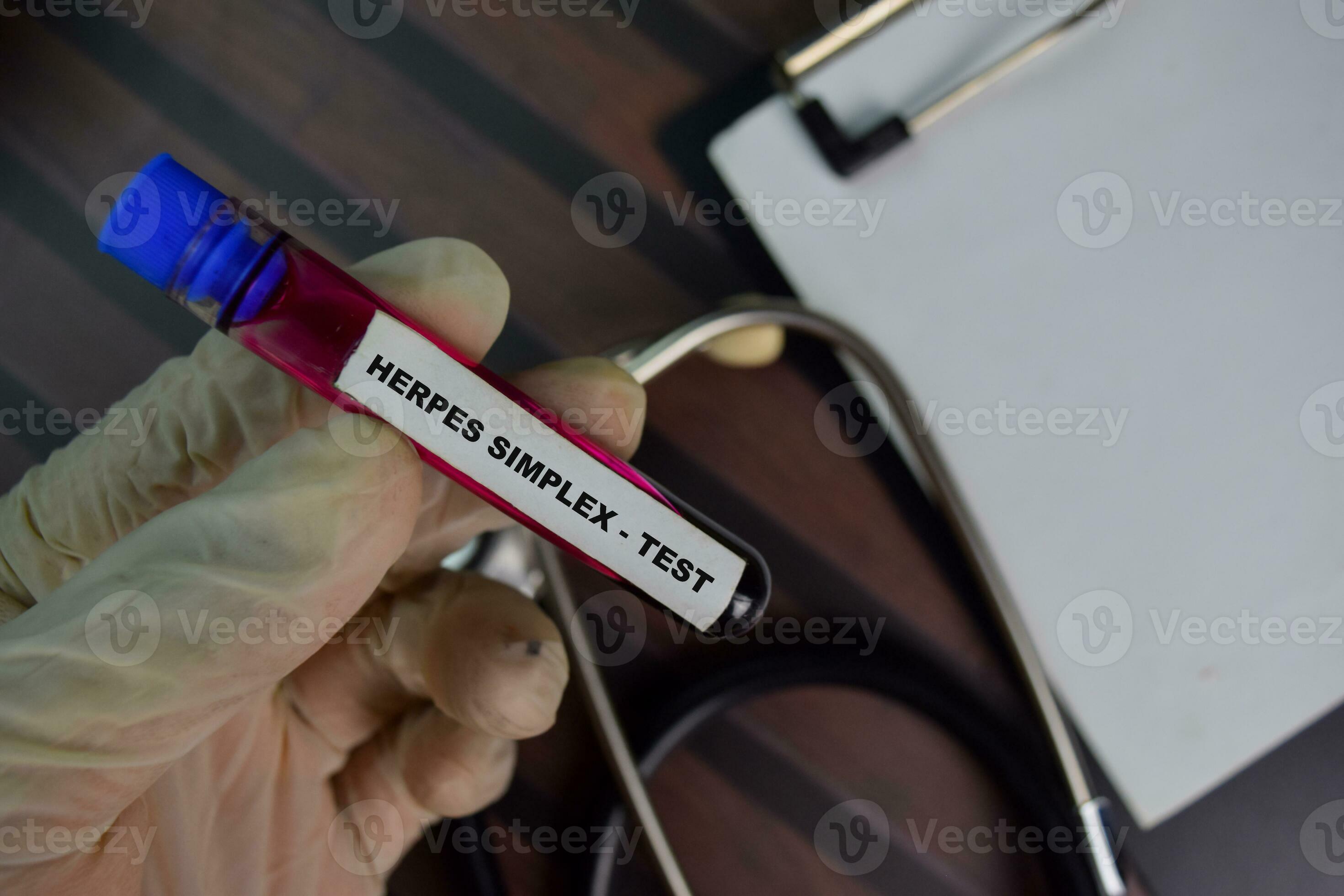 Herpes Simplex Test Test with blood sample. Top view isolated on office desk. Healthcare