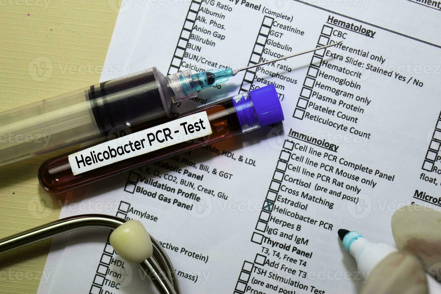 Helicobacter PCR - Test with blood sample. Top view isolated on office desk. Healthcare Medical concept photo