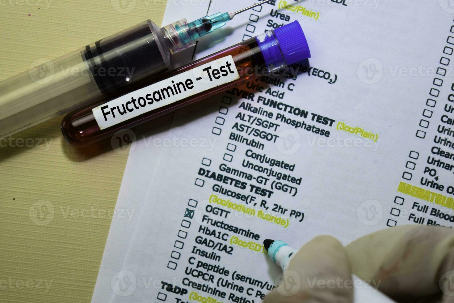Fructosamine Test with blood sample. Top view isolated on office desk Fructosamine Test with blood sample. Top view isolated on office desk
