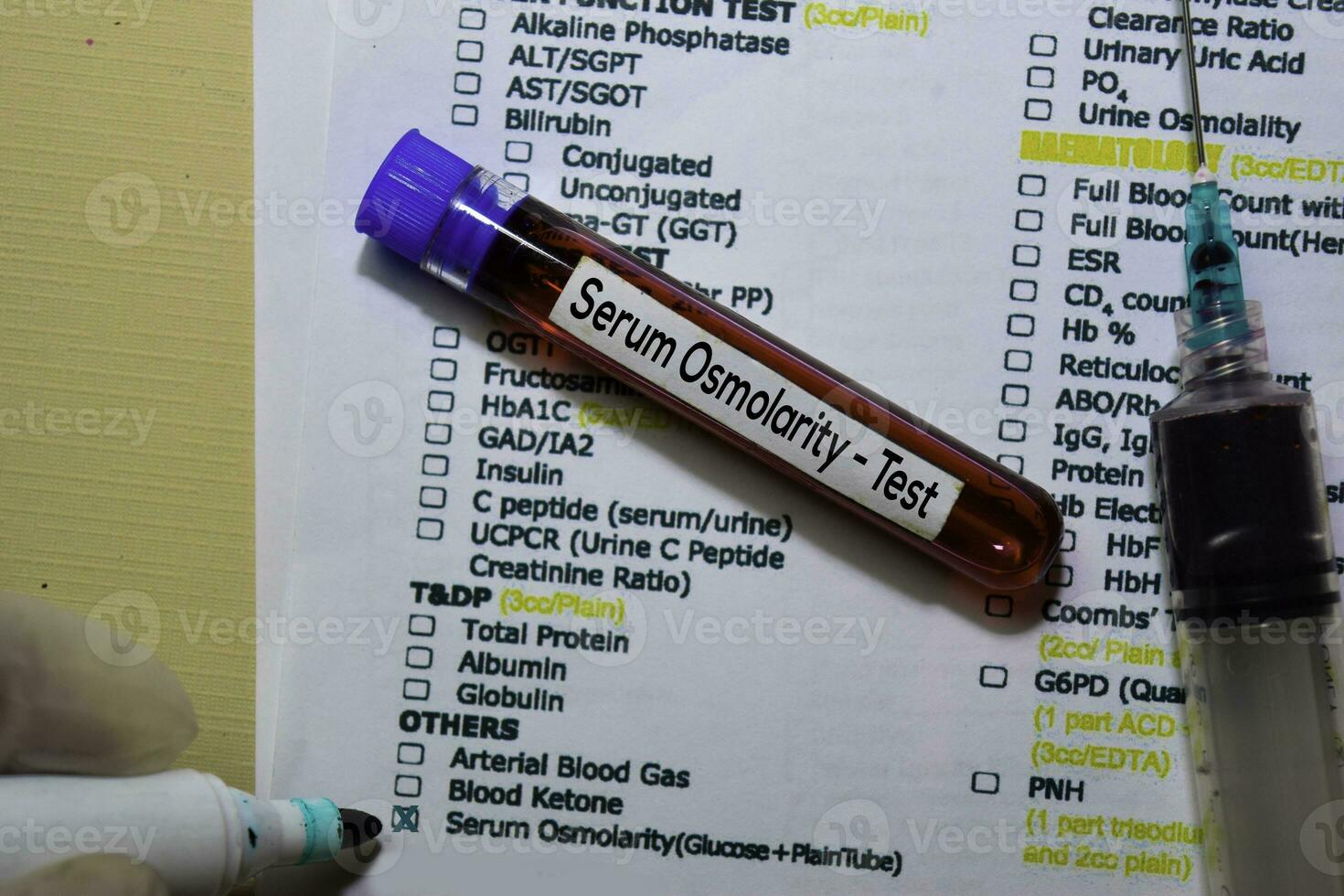 Serum Osmolarity Test with blood sample. Top view isolated on office