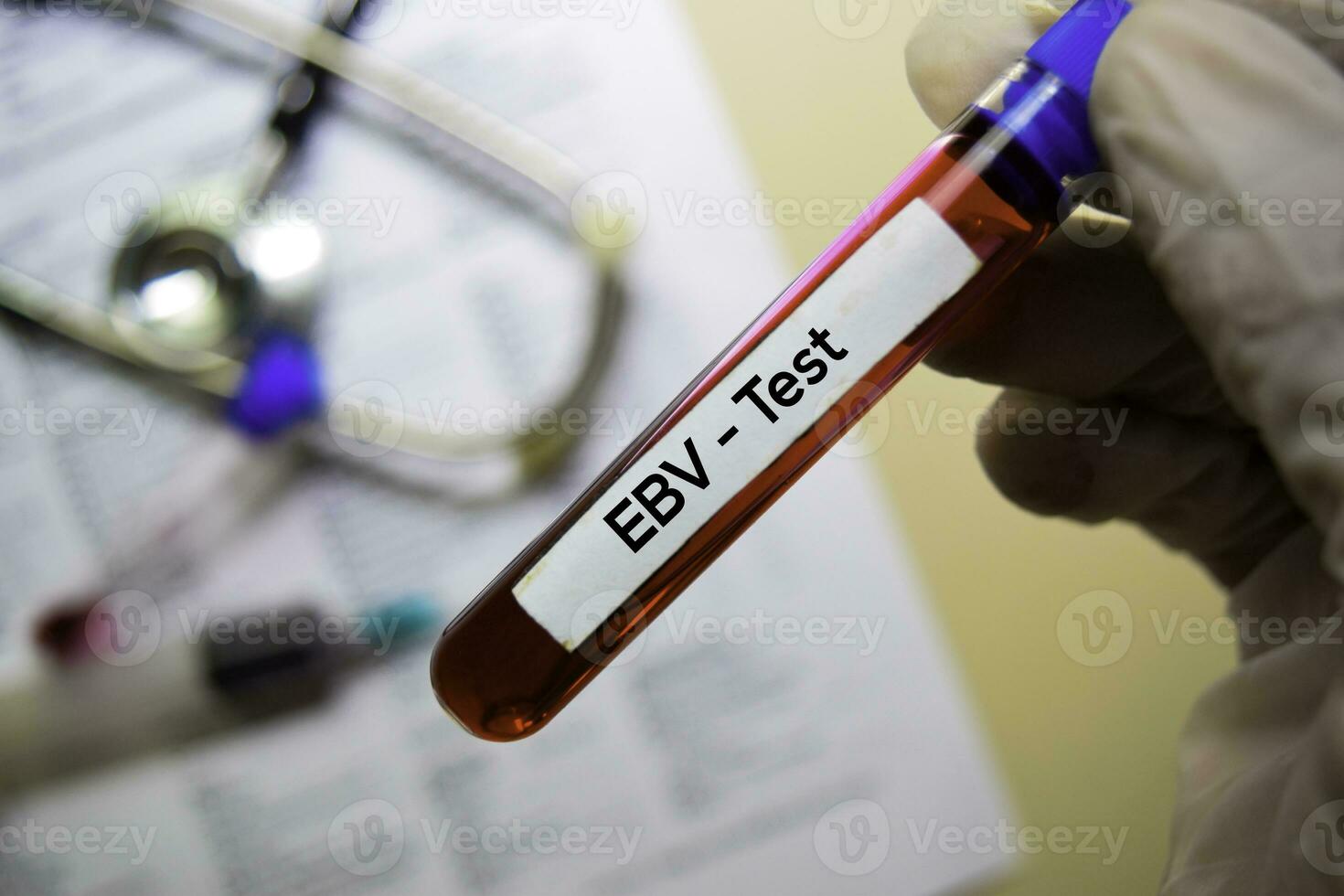 EBV Test with blood sample. Top view isolated on office desk