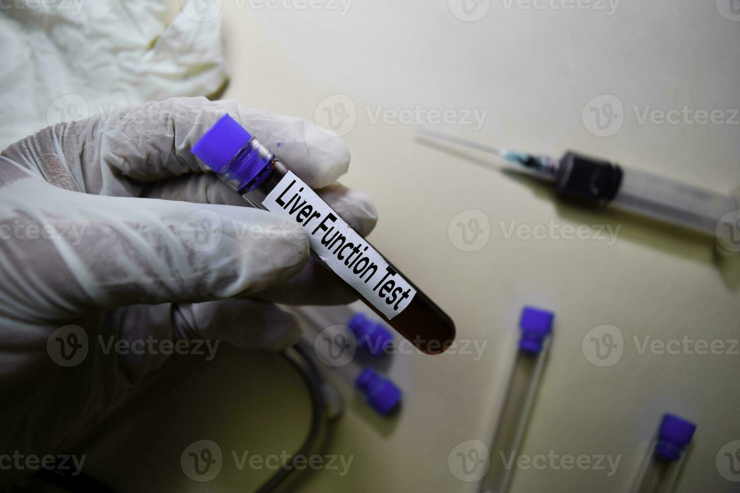 Liver Function Test text on Sticky Notes. Top view isolated on office desk. Healthcare Medical concept photo