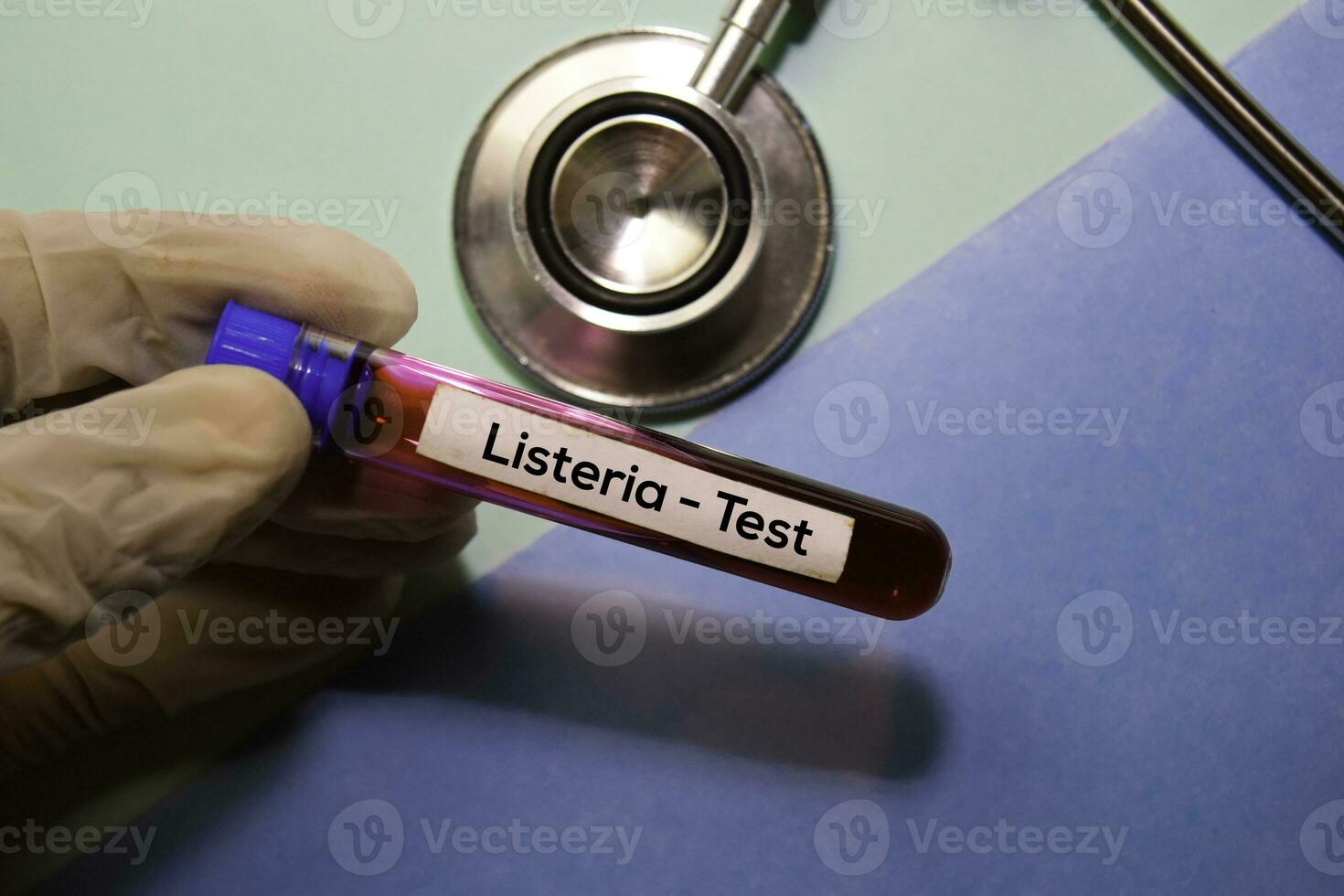 listeria - prueba con sangre muestra. parte superior ver aislado en oficina escritorio. cuidado de la salud médico concepto foto