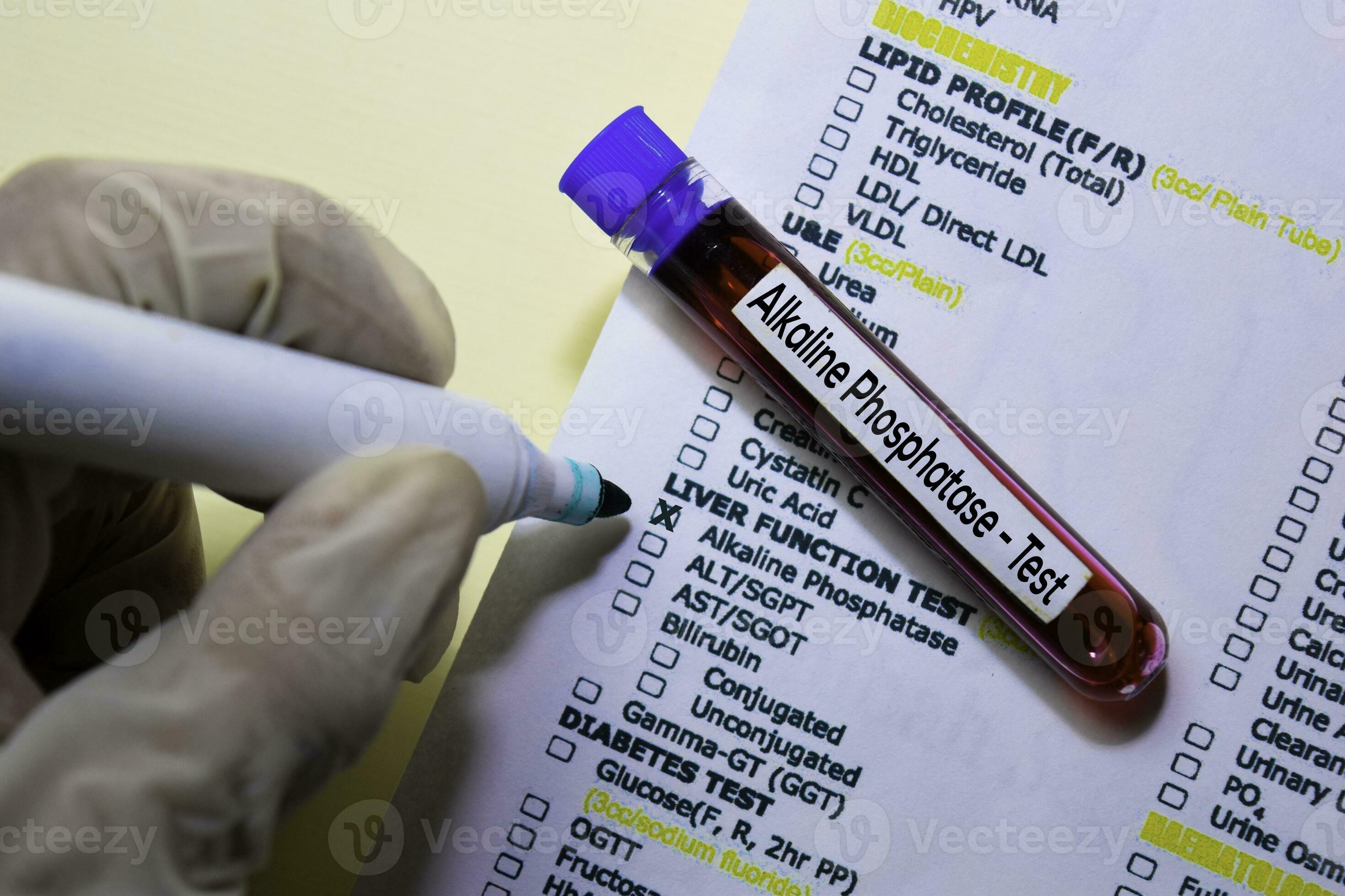 Alkaline Phosphatase Test with blood sample. Top view isolated on Alkaline Phosphatase Test with blood sample. Top view isolated on