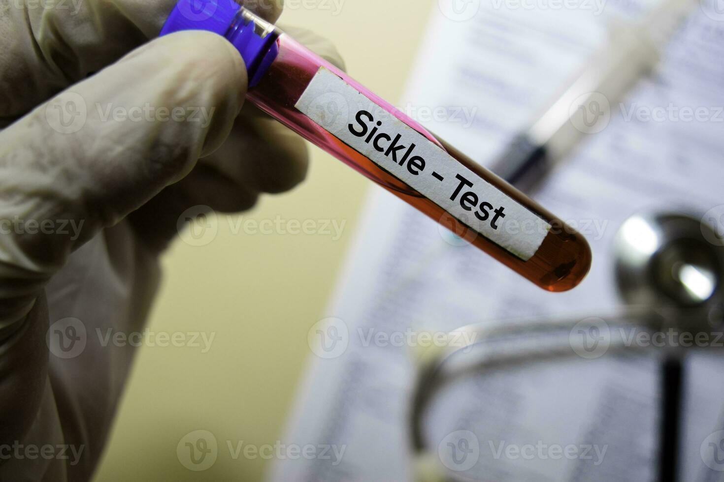 Sickle - Test with blood sample. Top view isolated on office desk. Healthcare Medical concept photo