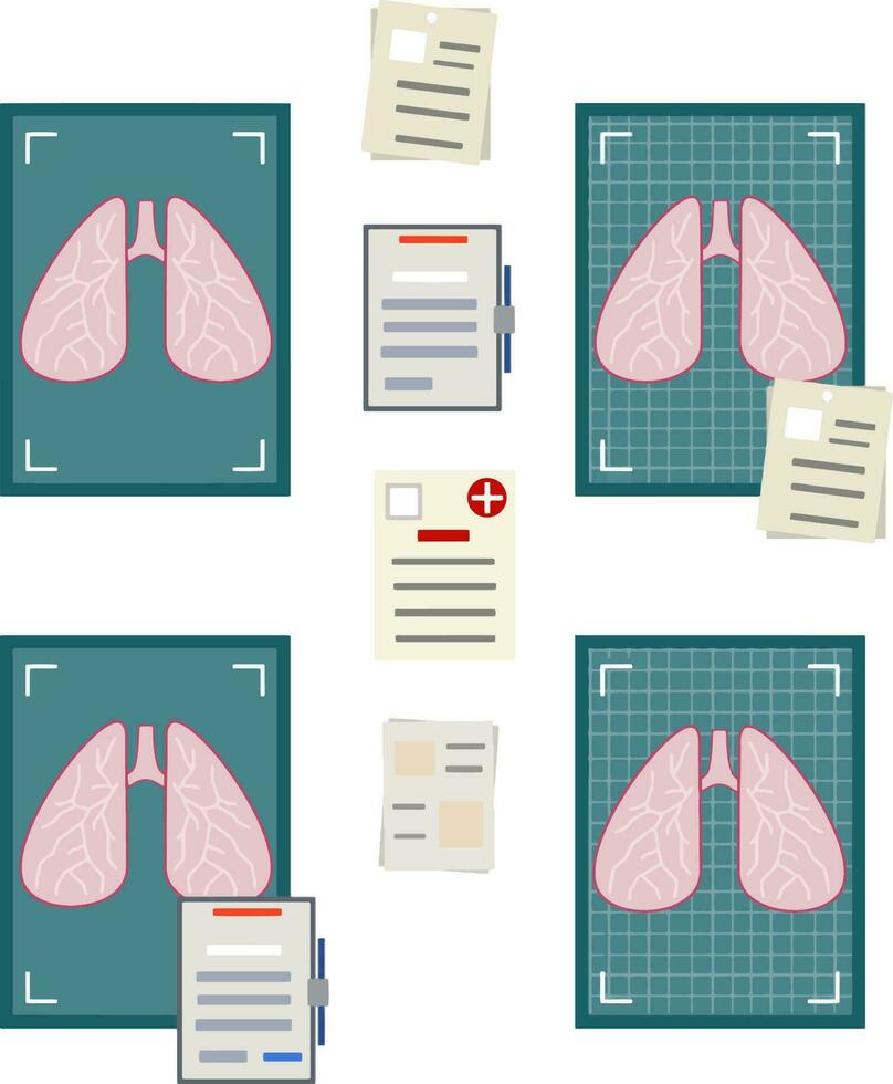 médico pruebas y diagnóstico. problemas respiración y pulmones. interno humano Organo. radiografía y foto imagen en azul hoja. elemento de hospital y médico cuidado. dibujos animados plano ilustración. azul antecedentes vector