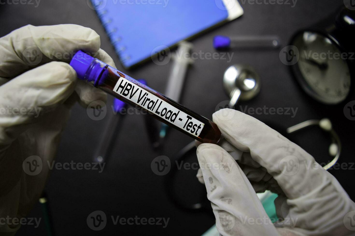 HBV Viral Load - Test with blood sample. Top view isolated on black background. Healthcare Medical concept photo