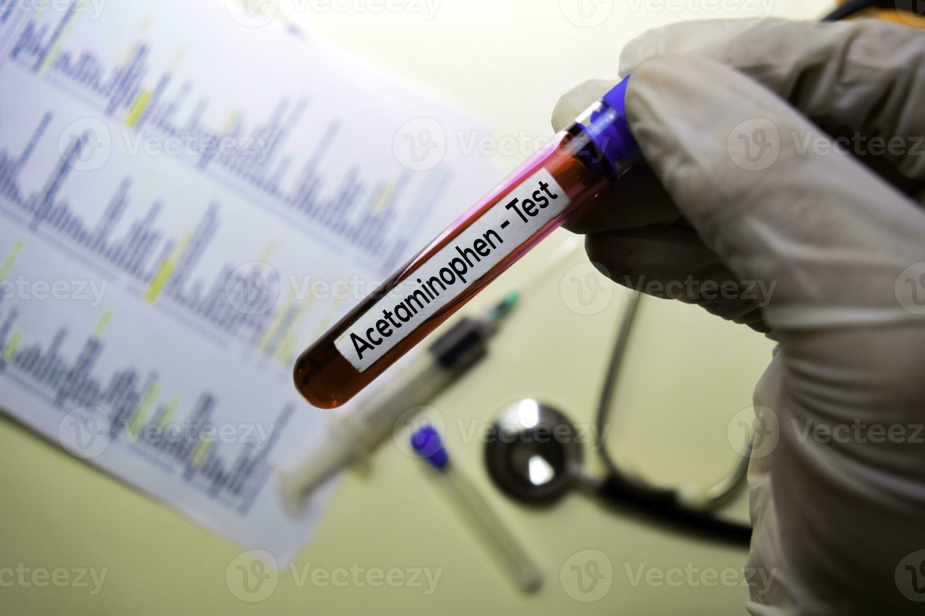 Acetaminophen Test with blood sample. Top view isolated on office